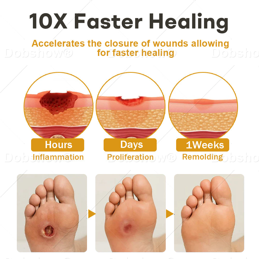 🔥Healrize® GlucoShield Bee Venom Wound Spray🐝