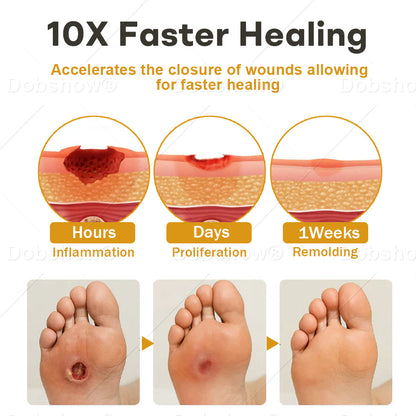 🔥Healrize® GlucoShield Bee Venom Wound Spray🐝