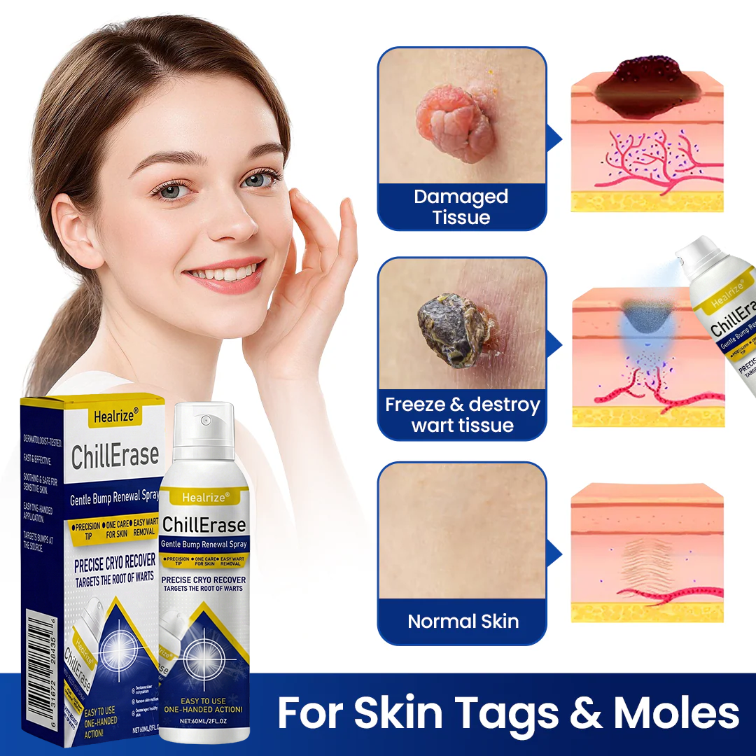 Healrize®ChillErase Gentle Bump Renewal Spray✨ — Pain-Free, Acid-Free Gentle Wart Removal