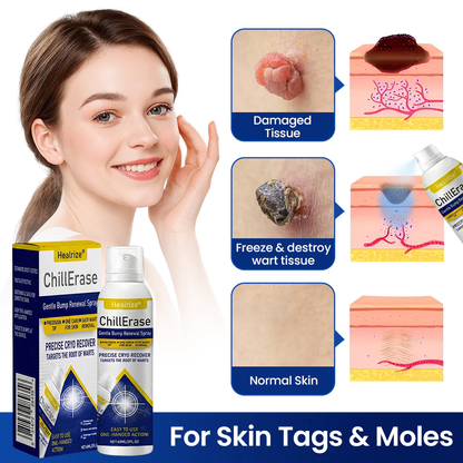Healrize®ChillErase Gentle Bump Renewal Spray✨ — Pain-Free, Acid-Free Gentle Wart Removal