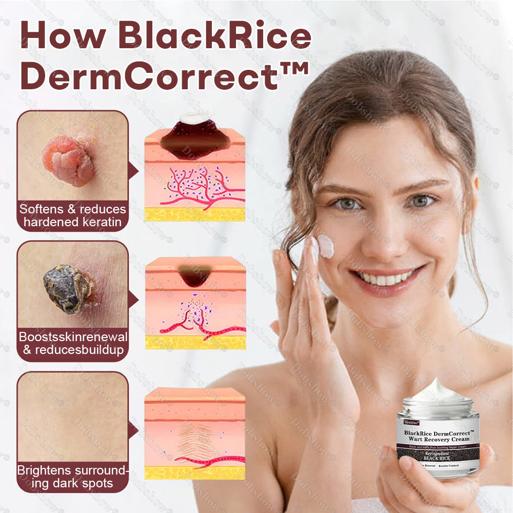 ✅Healrize® BlackRice DermCorrect™ Wart Recovery Cream —— Suitable for all skin types✨
