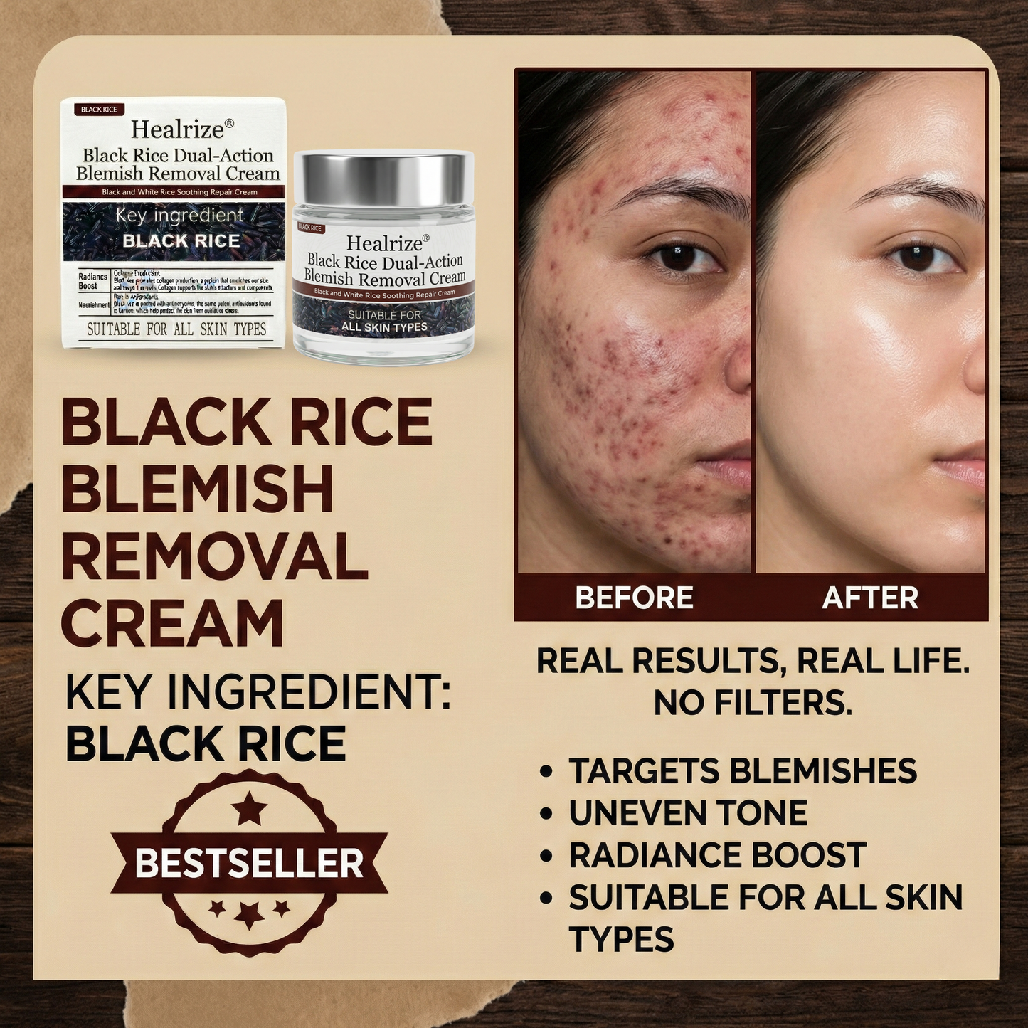 ✅Healrize®Black Rice Dual-Action Blemish Removal Cream