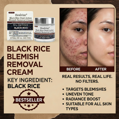 ✅Healrize®Black Rice Dual-Action Blemish Removal Cream