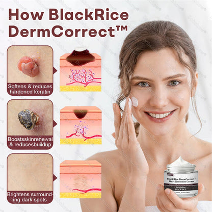 Healrize® BlackRice DermCorrect™ Wart Recovery Cream✨| Suitable for all skin types🌿