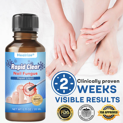 🔥Healrize®Nano Rapid Clear Nail Fungus Rapair Liquid – Effective in Seven Days, Permanently Eliminates the Root