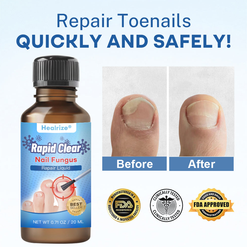 🔥Healrize®Nano Rapid Clear Nail Fungus Rapair Liquid – Effective in Seven Days, Permanently Eliminates the Root