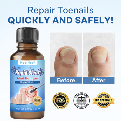 🔥Healrize®Nano Rapid Clear Nail Fungus Rapair Liquid – Effective in Seven Days, Permanently Eliminates the Root