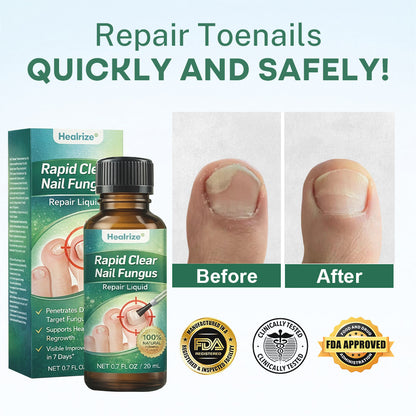 💅Healrize®Nano Rapid Clear Nail Fungus Rapair Liquid – Effective in Seven Days, Permanently Eliminates the Root 🔥