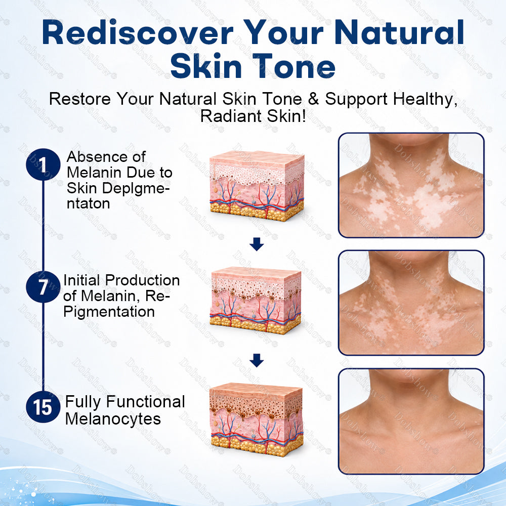 🍃🔥Healrize® Piperine Vitiligo Repigmentation Spray - 👨‍⚕️✅Steroid-Free Botanical Formula | Gentle & Effective for All Skin Types