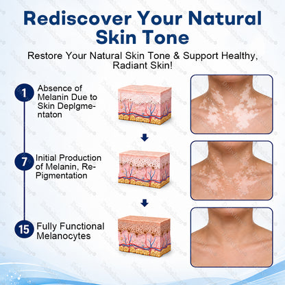 🍃🔥Healrize® Piperine Vitiligo Repigmentation Spray - 👨‍⚕️✅Steroid-Free Botanical Formula | Gentle & Effective for All Skin Types