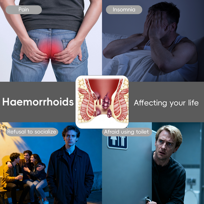 🌿Healrize® Fast Hemorrhoid PRO Spray