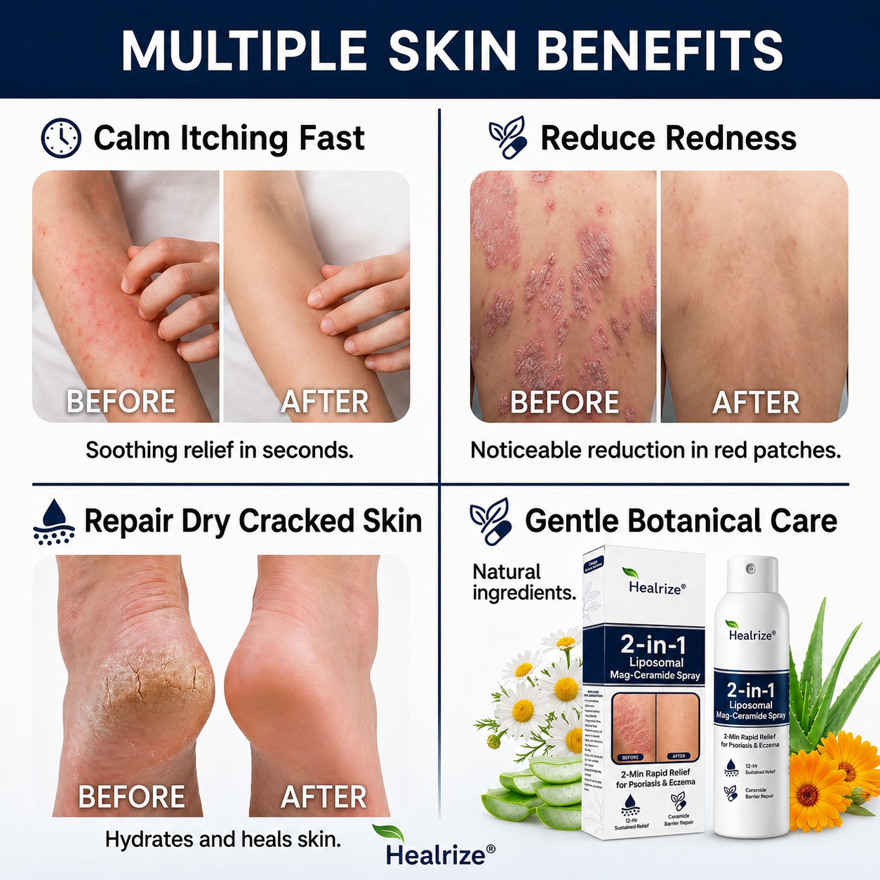 🏆Healrize® 2-in-1 Liposomal Mag-Ceramide Spray | 2-Min Rapid Relief for Psoriasis & Eczema (Full Body & Intimate Safe)