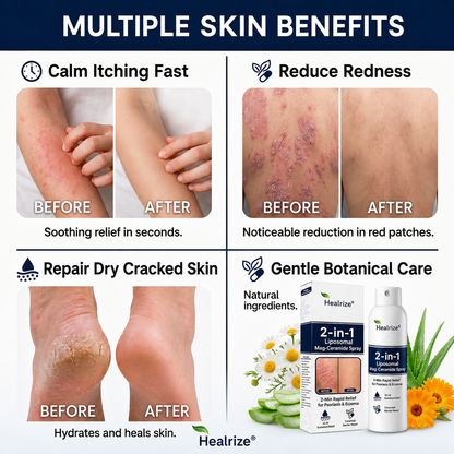 🏆Healrize® 2-in-1 Liposomal Mag-Ceramide Spray | 2-Min Rapid Relief for Psoriasis & Eczema (Full Body & Intimate Safe)