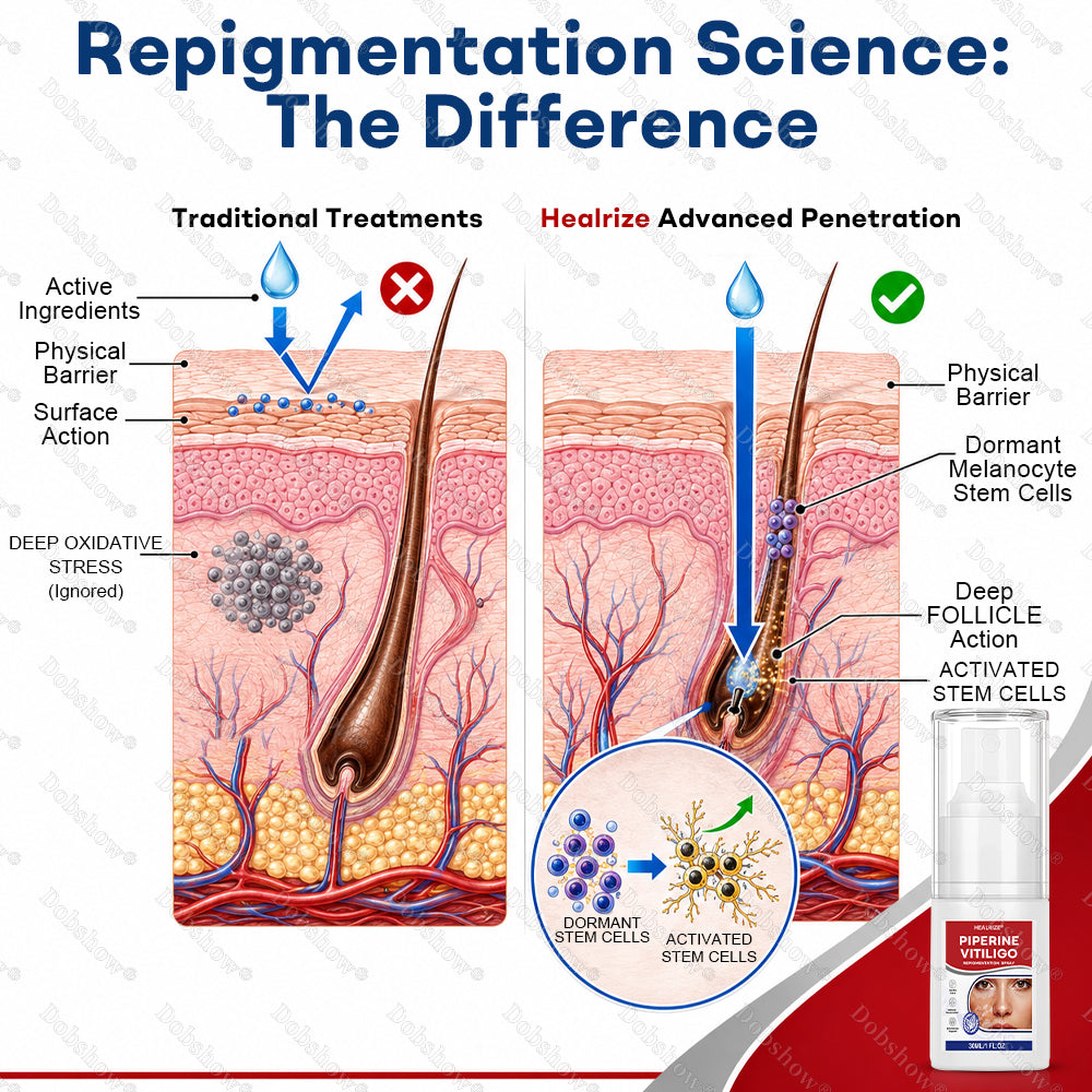🍃🔥Healrize® Piperine Vitiligo Repigmentation Spray - 👨‍⚕️✅Steroid-Free Botanical Formula | Gentle & Effective for All Skin Types