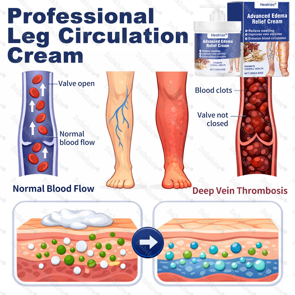 🔥Healrize® Advanced Edema Relief Cream | Herbal Soothing Ointment for Varicose Veins, Swelling & Leg Circulation🌿