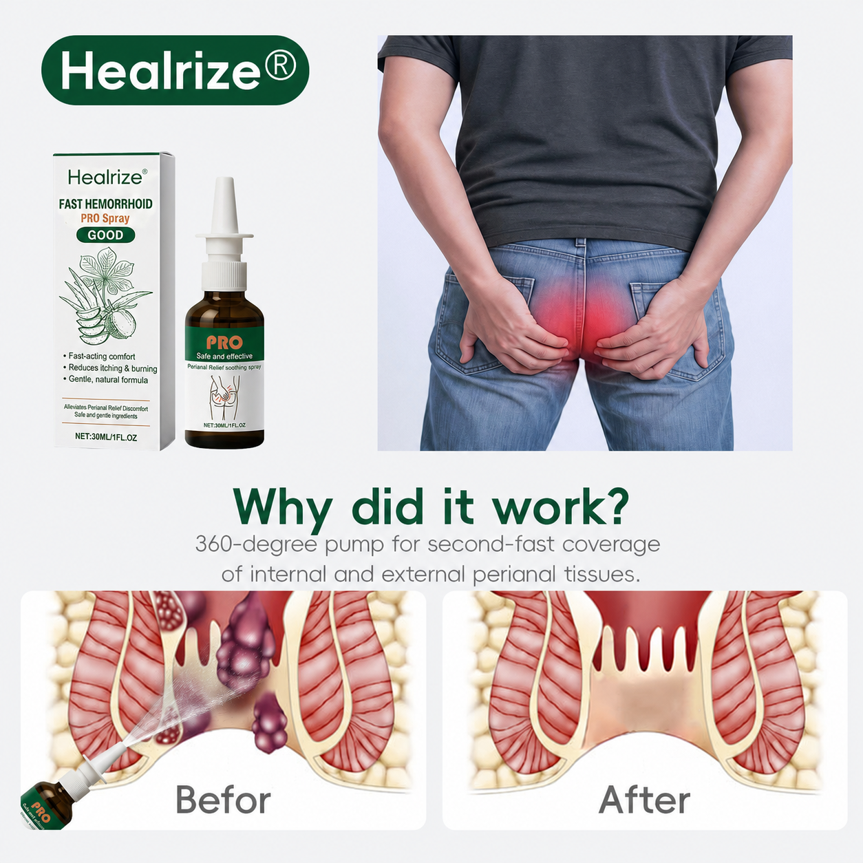 🌿Healrize® Fast Hemorrhoid PRO Spray