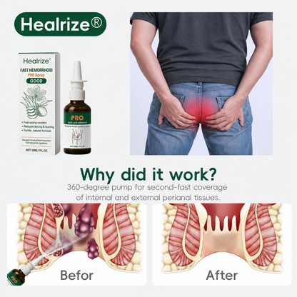 🌿Healrize® Fast Hemorrhoid PRO Spray