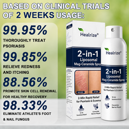 🏆Healrize® 2-in-1 Liposomal Mag-Ceramide Spray | 2-Min Rapid Relief for Psoriasis & Eczema (Full Body & Intimate Safe)