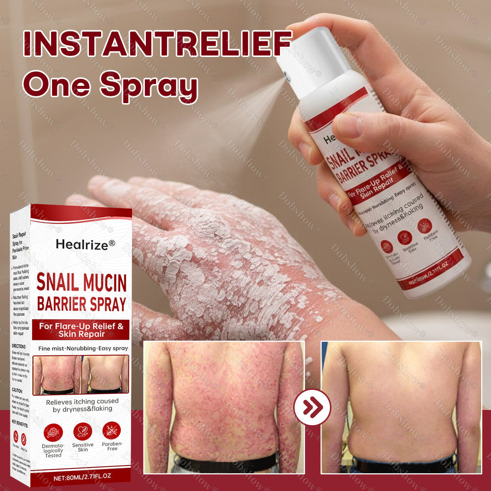 @@Healrize® Snail Mucin Barrier Spray for Flare-Up Relief & Skin Repair