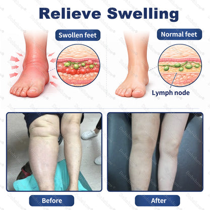 🔥Healrize® Advanced Edema Relief Cream | Herbal Soothing Ointment for Varicose Veins, Swelling & Leg Circulation🌿