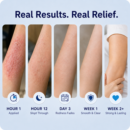 🏆Healrize® 2-in-1 Liposomal Mag-Ceramide Spray | 2-Min Rapid Relief for Psoriasis & Eczema (Full Body & Intimate Safe)