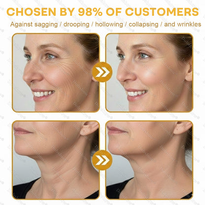 😍💝Healrize®Bee Venom Botox 7-Day Lift Stick: On-the-Go Firming🔥