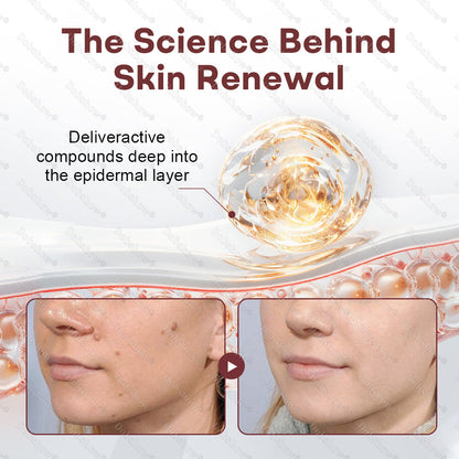 Healrize® BlackRice DermCorrect™ Wart Recovery Cream✨| Suitable for all skin types🌿