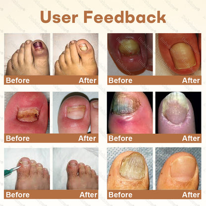 Healrize® NailRescue BeeVenom Renewal Spray🐝