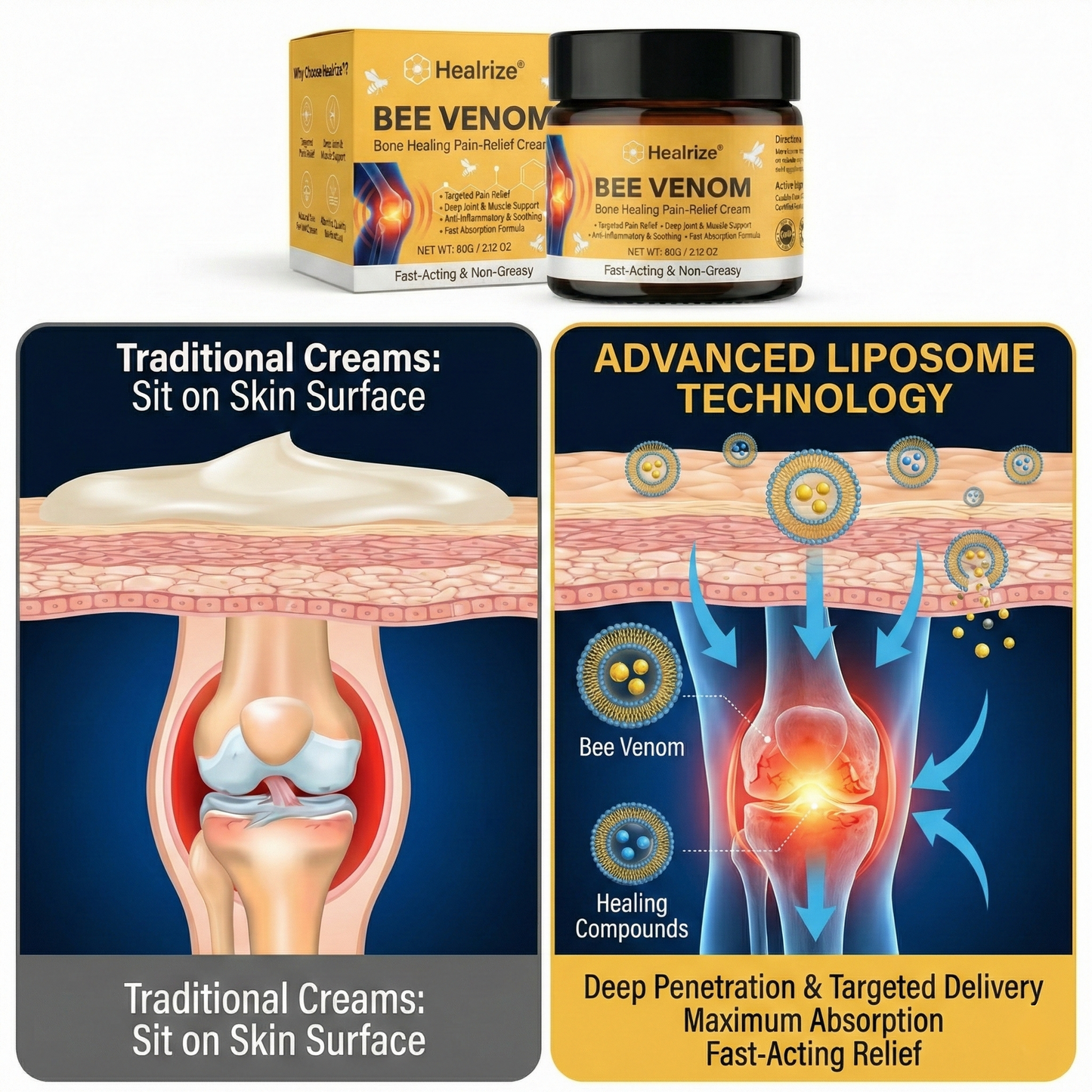 Healrize®Bee Venom Bone Healing Pain-Relief Cream🐝