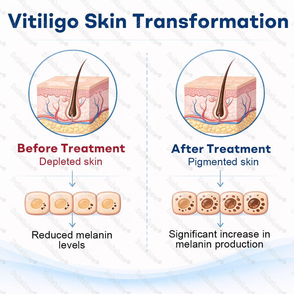 🔥Healrize® Piperine Vitiligo Repigmentation Spray - 👨‍⚕️✅Steroid-Free Botanical Formula | Gentle & Effective for All Skin Types