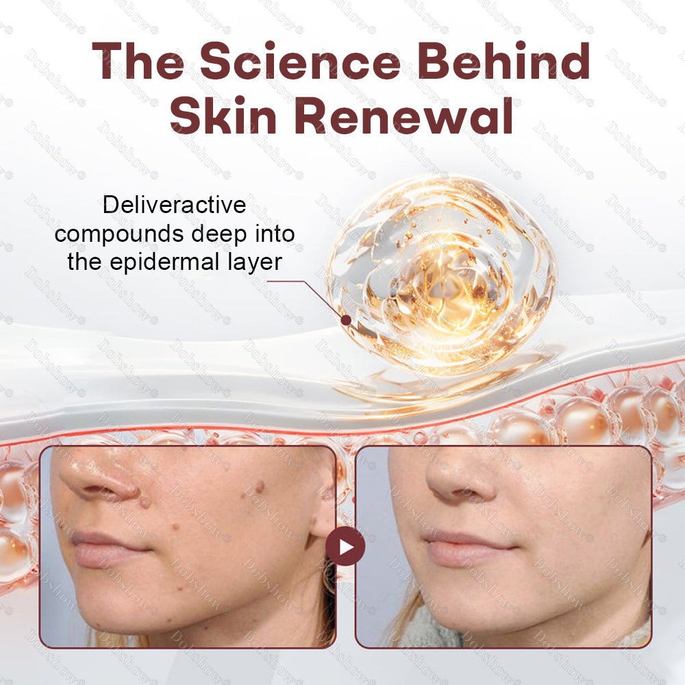 ✅Healrize® BlackRice DermCorrect™ Wart Recovery Cream —— Suitable for all skin types✨