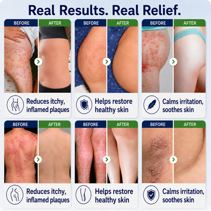 🌿🔥Healrize® 2-in-1 Liposomal Mag-Ceramide Spray | 2-Min Rapid Relief for Psoriasis & Eczema (Full Body & Intimate Safe)
