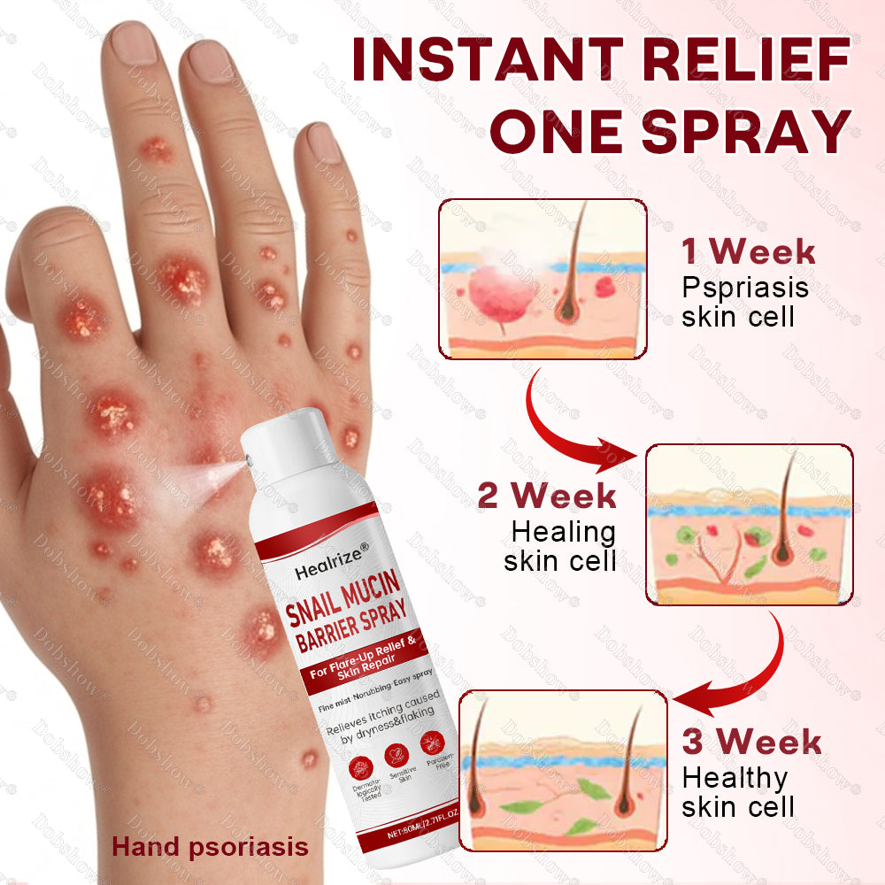 @@Healrize® Snail Mucin Barrier Spray for Flare-Up Relief & Skin Repair