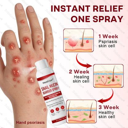 @@Healrize® Snail Mucin Barrier Spray for Flare-Up Relief & Skin Repair