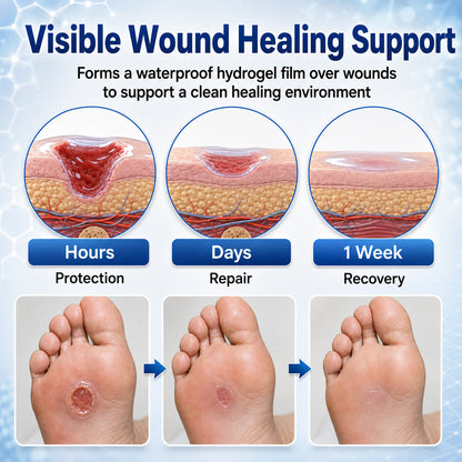 💪🔥Healrize® Advanced Barrier Spray | Fast-Drying Liquid Bandage for Wound Care