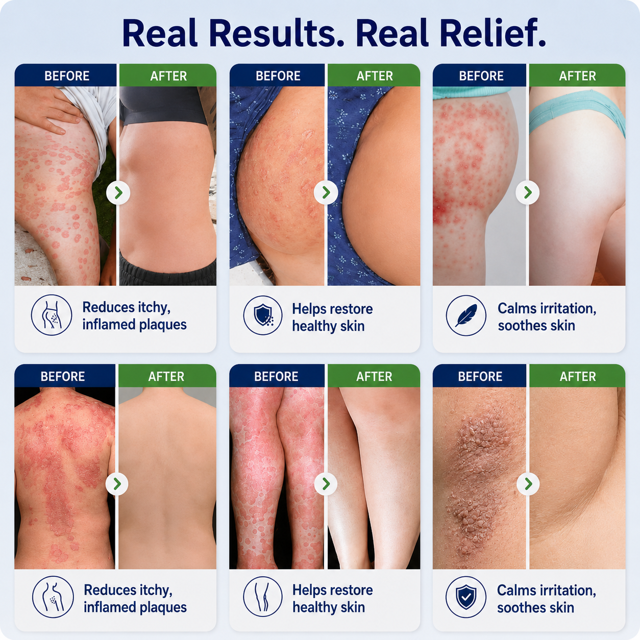 🏆Healrize® 2-in-1 Liposomal Mag-Ceramide Spray | 2-Min Rapid Relief for Psoriasis & Eczema (Full Body & Intimate Safe)