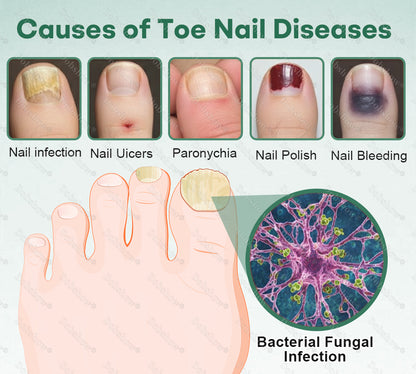 💅Healrize®Nano Rapid Clear Nail Fungus Rapair Liquid – Effective in Seven Days, Permanently Eliminates the Root 🔥