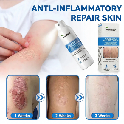 🔥Healrize® Magnesium Botanical Spray – Advanced Skin Recovery for Psoriasis & Eczema | Rapid Soothing, Steroid-Free
