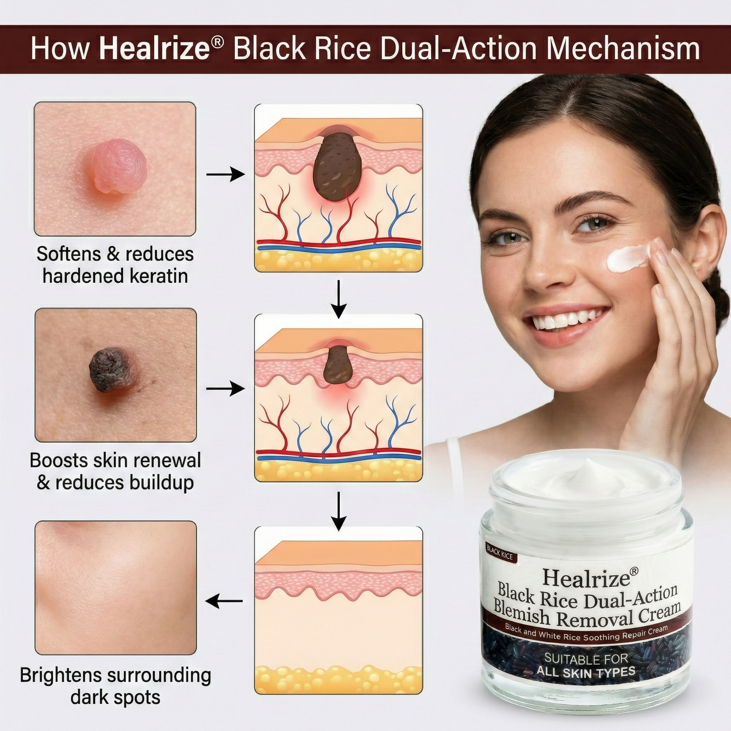 ✅Healrize®Black Rice Dual-Action Blemish Removal Cream