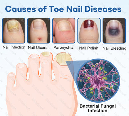 🔥Healrize®Nano Rapid Clear Nail Fungus Rapair Liquid – Effective in Seven Days, Permanently Eliminates the Root