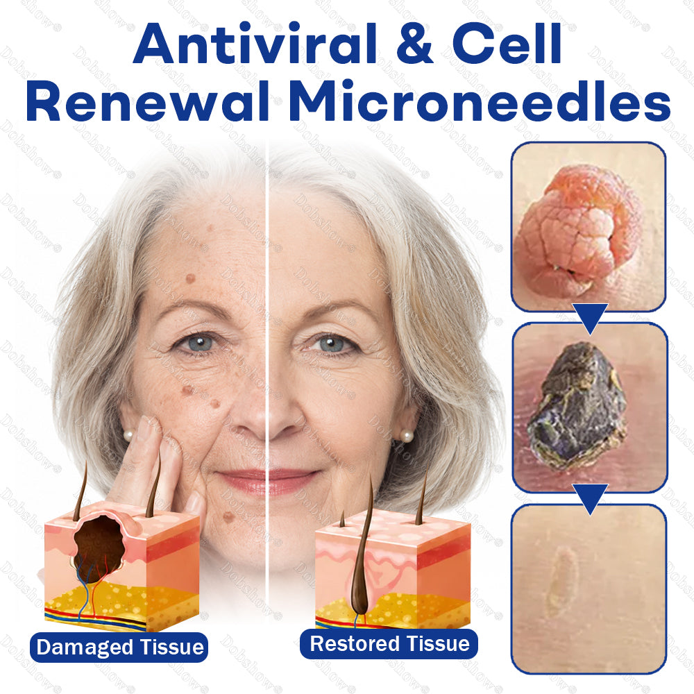 💥Best Seller🔥Dobshow® 3-in-1 Microneedle & Hydrocolloid Skin Tag Patch