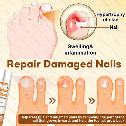 Healrize® NailRescue BeeVenom Renewal Spray🐝