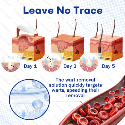 💥Best Seller🔥Dobshow® 3-in-1 Microneedle & Hydrocolloid Skin Tag Patch