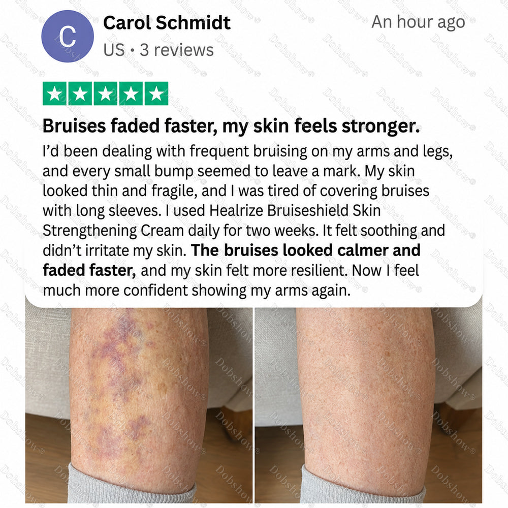 💥62K+SOLD🔥Dobshow® BRUISESHIELD Skin Strengthening Cream