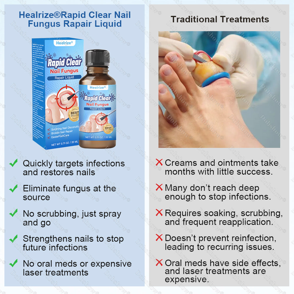 🔥Healrize®Nano Rapid Clear Nail Fungus Rapair Liquid – Effective in Seven Days, Permanently Eliminates the Root