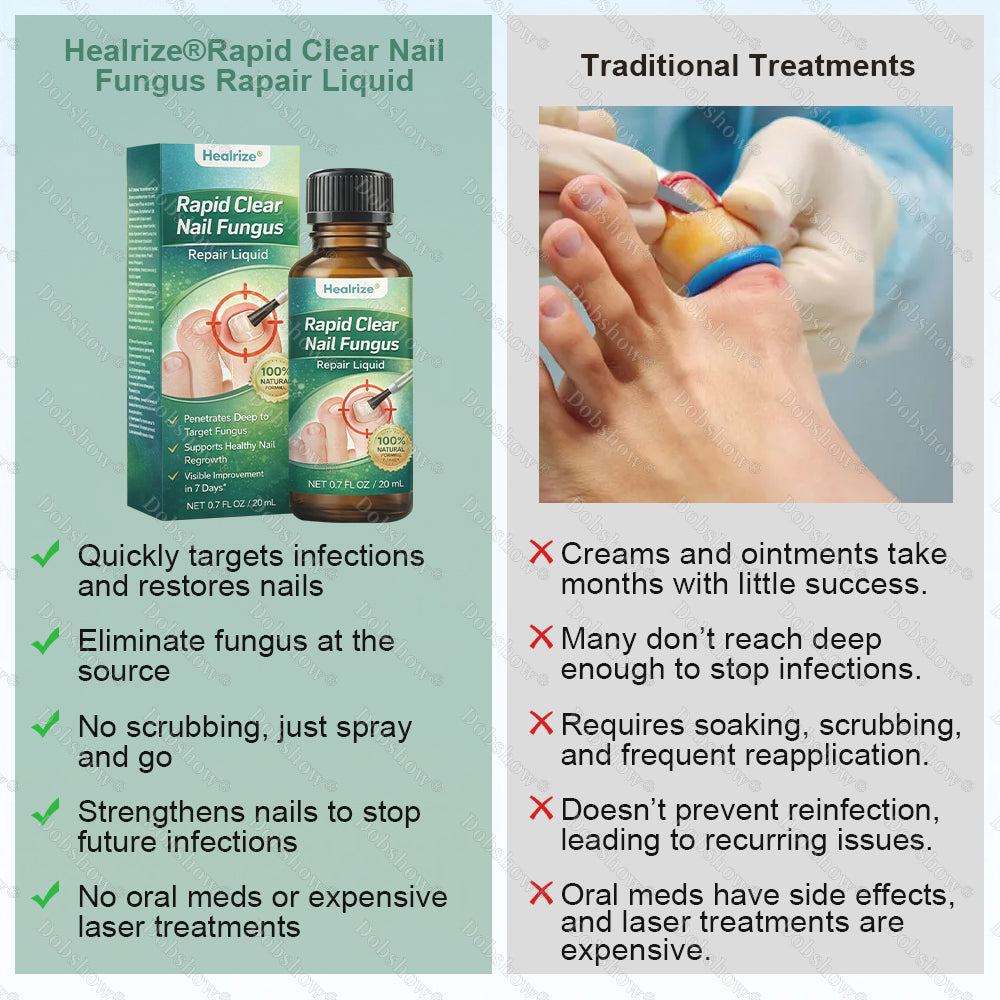 💅Healrize®Nano Rapid Clear Nail Fungus Rapair Liquid – Effective in Seven Days, Permanently Eliminates the Root 🔥