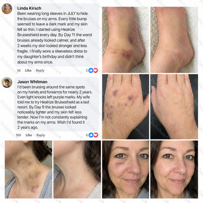 💥62K+SOLD🔥Dobshow® BRUISESHIELD Skin Strengthening Cream