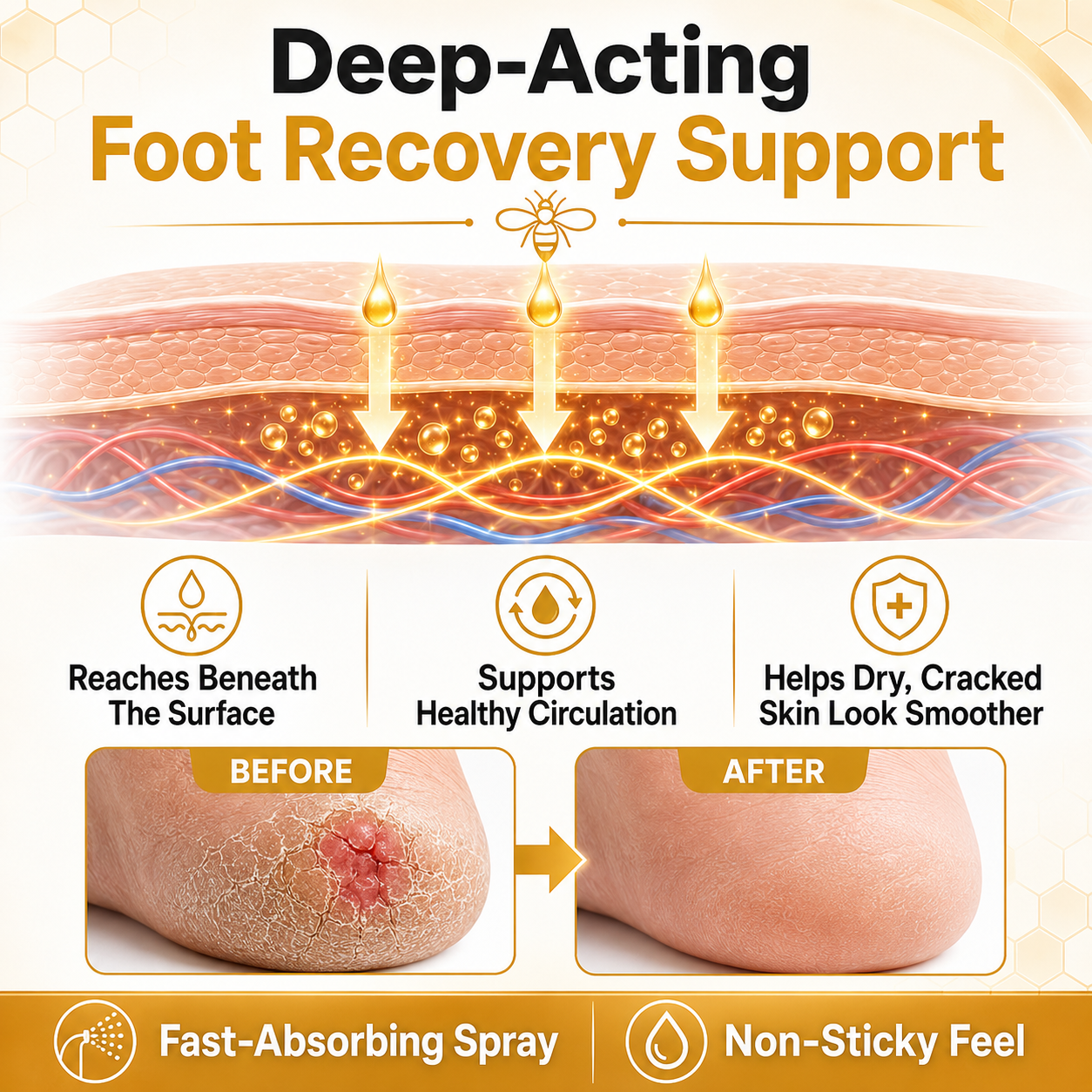🎉Limited-time discount🎉Healrize®Bee Venom Intensive Diabetic Foot Treatment Spray🔥89K+SOLD🔥